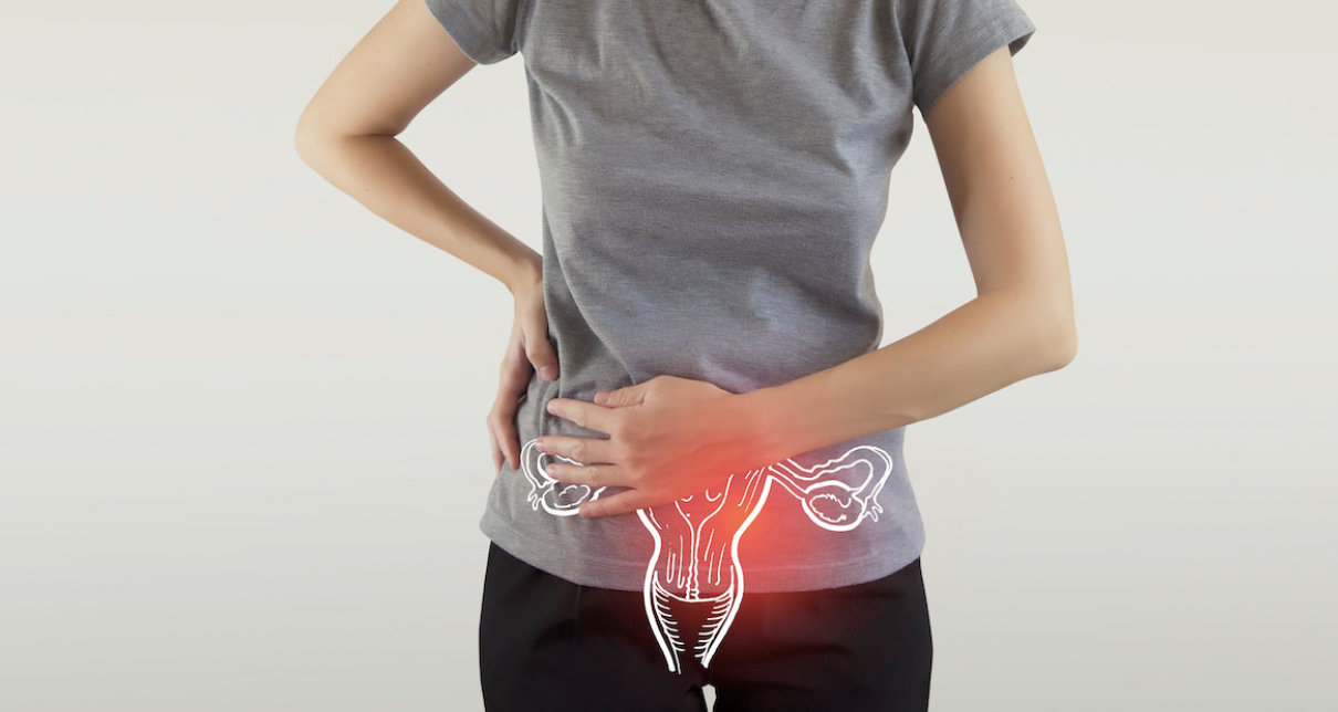 CBD Suppositories for Pelvic Discomfort: A New Solution Backed by Health Professionals
